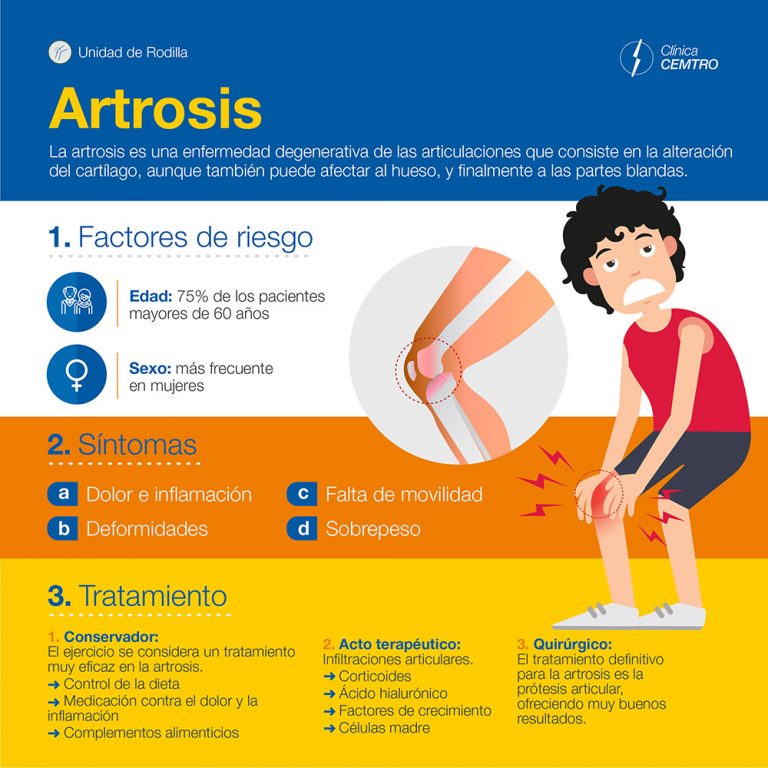 Artrosis  Tratamiento, síntomas y prevención en CuídatePlus